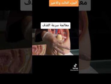 ولا حياء في العلم اهم مشكله بتواجه اي رجل سرعه القذف طريقه علاجها بدون اي ادويه👍🏻👍🏻 ط