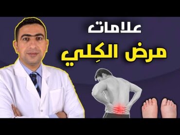 علامات مرض الكلى المبكرة  ٨ علامات تحذيرية تدل على أن الكلى لا تعمل بشكل صحيح