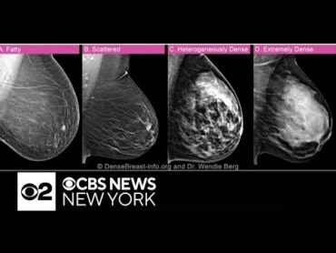 Columbia University School of Nursing dean says breast density camouflaged her cancer