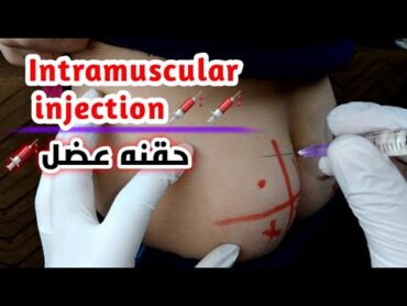 تعلم اعطاء الحقن العضل بدون كلكعه او ازرقاق  give intramuscular injection without swelling