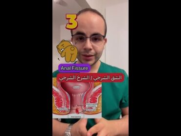 Anal Fissure  الشق الشرجي/الشرخ الشرجي