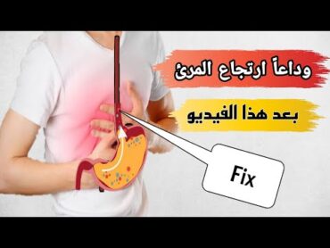 اعراض ارتجاع المرئ وعلاجه نهائيا بخطوات بسيطة جدا الحموضه اسبابها وعلاجها