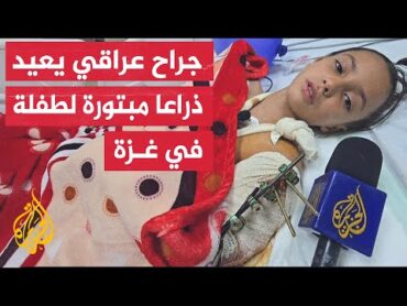 طلب إحضار الجزء المبتور من تحت الركام.. جراح عراقي متطوع يتمكن من إعادة زرع ذراع طفلة في غزة