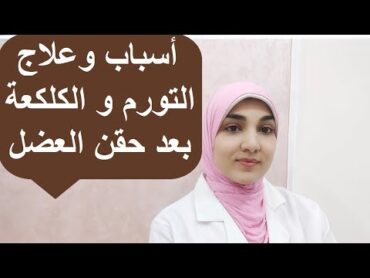 طرق علاج الكلكعة والتورم بعد حقن العضل وأسباب حدوثها وكيفية الوقاية منها؟