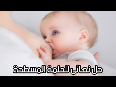 الحل السحري لاستخراج حلمة الصدر و تحسين الرضاعة الطبيعية ( nipple extraction )  دكتور حاتم فاروق