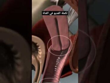 هبوط الرحم