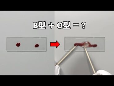 異なる血液型の血を混ぜると、衝撃的な現象が起こります。