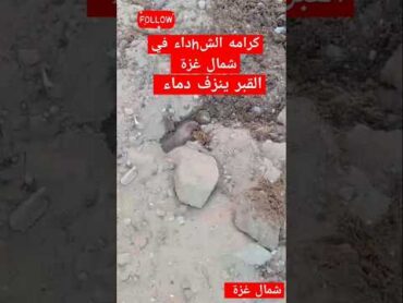 كرامه الشhداء في شمال غزة القبر ينزف غزة الجزيره اكسبلور متابعه تيك توك voiceeffects لايك duo