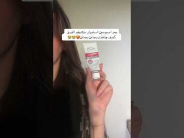 كريم الهبة أسطورة محاربة التصبغات  كريم ACM depiwhite  تسوق الأن  stsstores.com