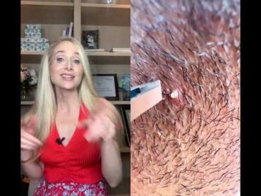 4 DERM TIPS TO PREVENT INGROWN HAIRS shorts