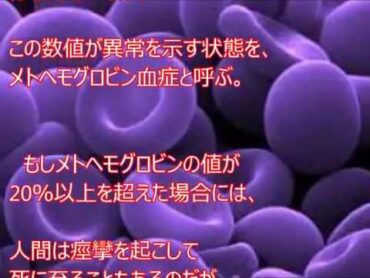 近親婚を繰り返した結果？一家全員まっ青な肌のファゲイト一族とは？【閲覧注意】‪