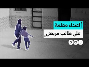 معلمة تعتدي بالضرب على طالب مريض سكري بسبب دخوله المتكرر لدورة المياه