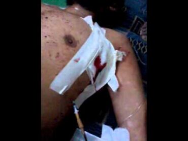تفجير صدر بسرنغ و جهاز سيروم