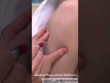 حقن عضلي بالكتف بطريقة سهلة وسريعة محمد قاسم shorts