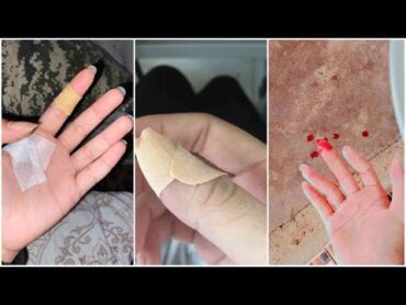 صور ايد مجروحه كانها لك