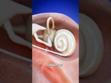 How Some Deaf People Can Hear 🤔