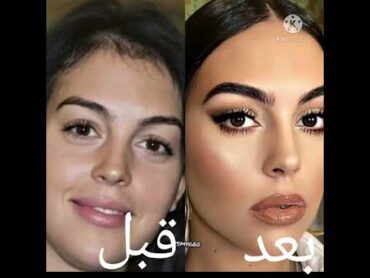 جورجينا قبل وبعد عملية التجميل تفتكروا انهي احلى🤔