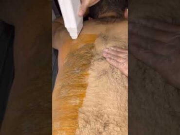 هل يجوز حلاقة شعر الصدر ؟