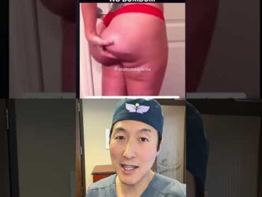 Why I Don’t Recommend Butt Implants! implantsurgery