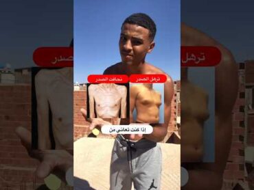 حل مشكلة نحفت الصدر و ترهل عضلات الصدر 💪🏼✅                                       تمارين عضلات صدر
