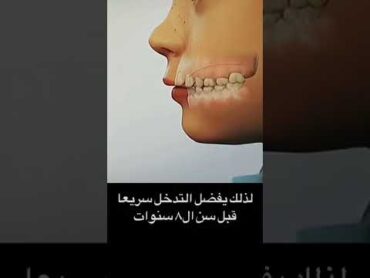 مص الاصبع ممكن يسبب مشاكل خطيرة عند الاطفال.. و لازم يتم تصلحها قبل سن ال ٨ سنوات..