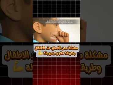 النتائج السلبية لعادة مص الاصابع عند الاطفال 🫣 وطريقة علاجها بسهولة لتجنب التقويم تماما 💪