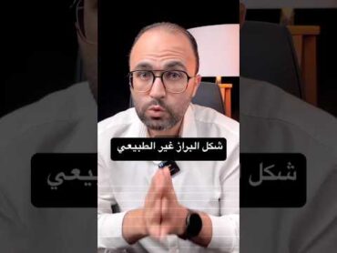 شكل البراز الغير طبيعي  دكتور ايهاب صالح  دكتورك الامين