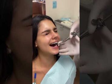 Numb Numb Time ! Share your numb or injection experience ! dentist dentalhumor teethchallenge