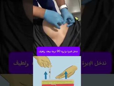 تعلم اخذ ابره العضل اكسبلور