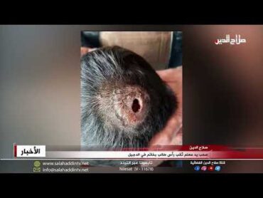 سحب يد معلم ثقب رأس طالب بخاتم في الدجيل