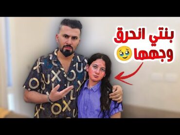 انحرق وجه ميرا 😥اخدناها على المستشفى ليش صار هيك  😭