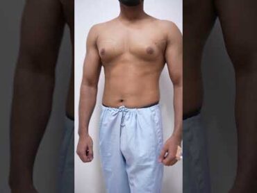 How To Get Rid Of Man Boobs Permanently shorts