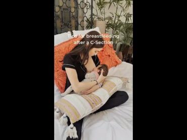 Tips for breastfeeding after a CSection