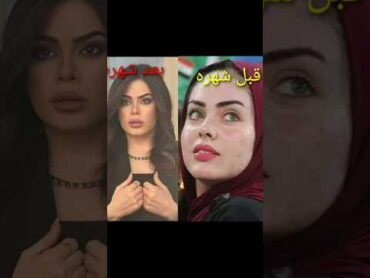اشرقت غانم حميد قبل وبعد الشهره اكسبلور explore المميز