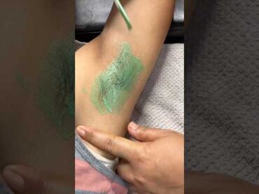 First time sensitive skin armpit waxing by rica green apple wax / Waxing tutorial/ skincare waxing