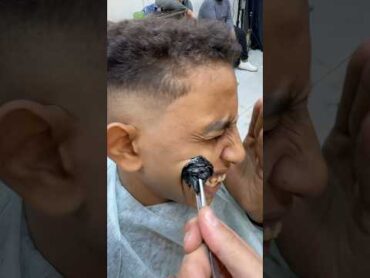 ازاله الحبايه م الخد بالملقاط✂️💈fyp viral hashtag comment explore follow fun funny foryou