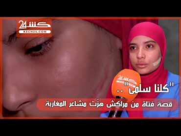 "كلنا سلمى".. قصة فتاة من مراكش هزّت مشاعر المغاربة