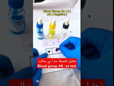 تحليل فصيلة دم أ بي سالب blood group AB ve test shorts