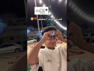 عبادي محمد وقصة عيون صاحبه👀😰explore اكسبلور السعودية foryou تحدي غرائبتركيا