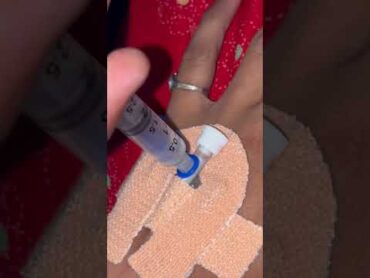 How to give injections in IV Cannula  iv injection